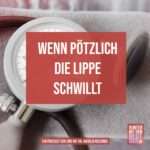 Wenn plötzlich die Lippe schwillt