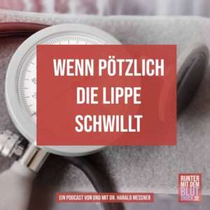 Wenn plötzlich die Lippe schwillt